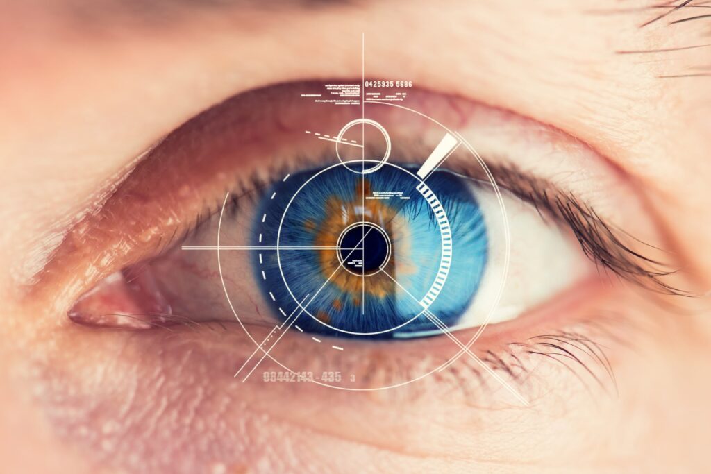 LASIK Surgery